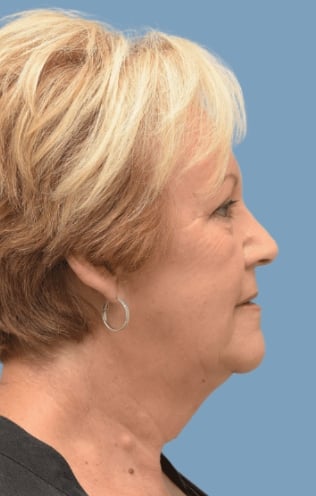 Facelift Sydney banner img1