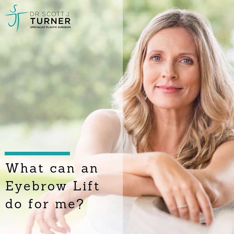 Brow lift surgery by Dr Turner Brow lift expert facial surgeon sydney