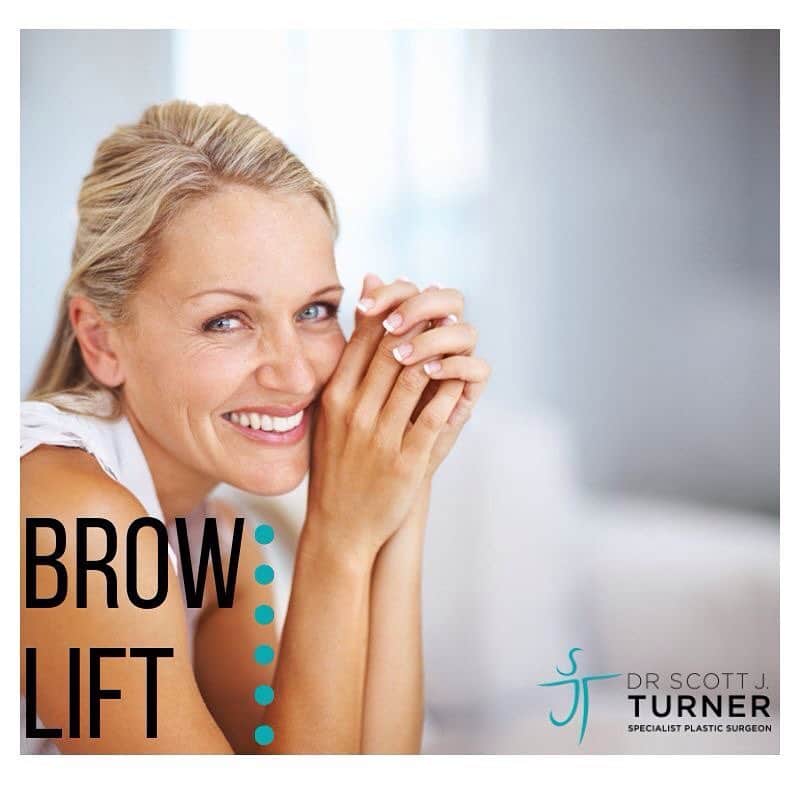 Brow Lift surgery by Dr Scott Turner Brow lift expert Sydney