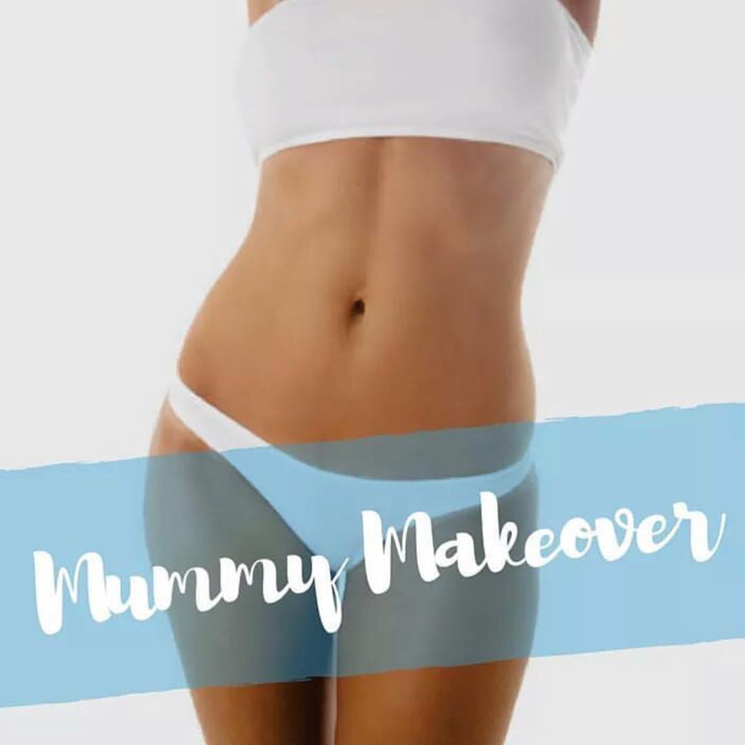 Mummy-Makeover-Recovery_Dr-Turner_Sydney