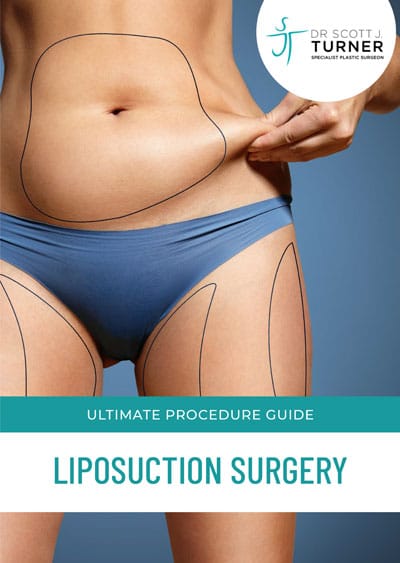 Guide Liposuction