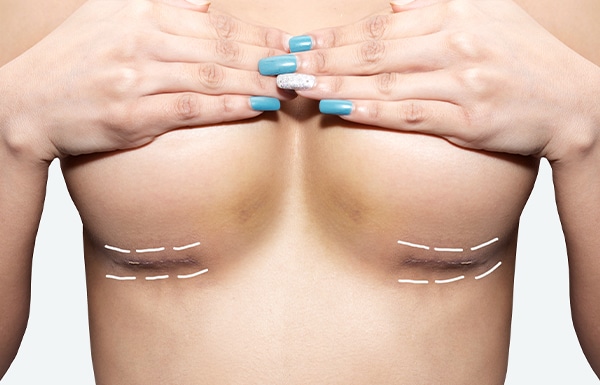 Breast Augmentation Surgery Melbourne