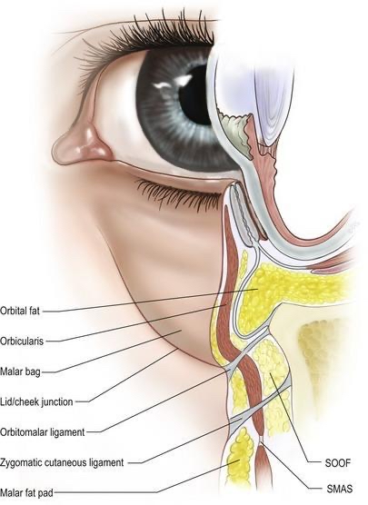 Cheek Lift Surgery in 2026: A Modern Look at Midface Correction 1 Mid Face Lift