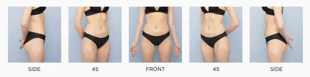 Abdomen Photo Taking Guide