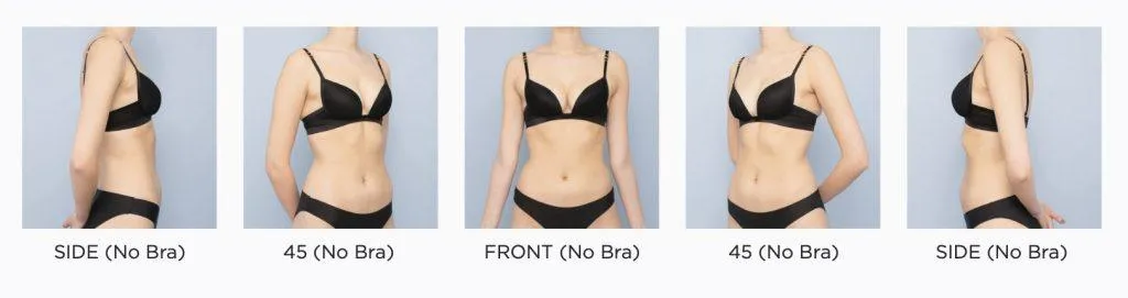 Breast Photo Taking Guide