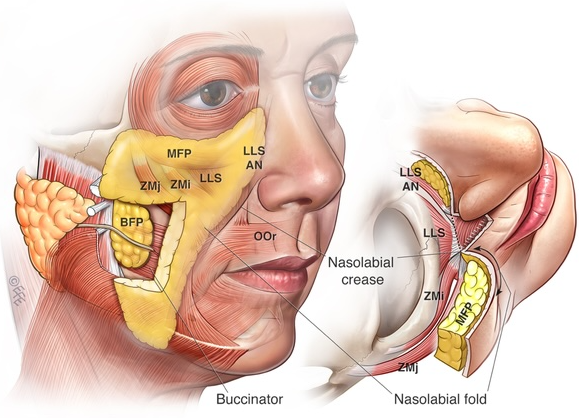 Does a Deep Plane Facelift Improve Nasolabial Folds? - 3